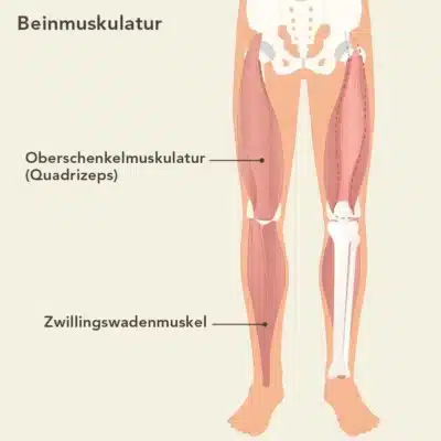 Die Grafik zeigt die Beinmuskulatur am menschlichen Skelett. Oberhalb des Knies ist der vierköpfige Oberschenkelmuskel zu sehen und der Zwillingswadenmuskel liegt unterhalb des Knies.