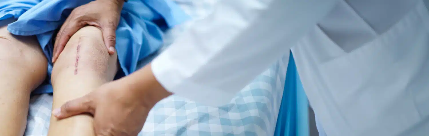 Bein mit langer Operationsnarbe am Knie, Hände von Arzt oder Therapeut betasten Bein