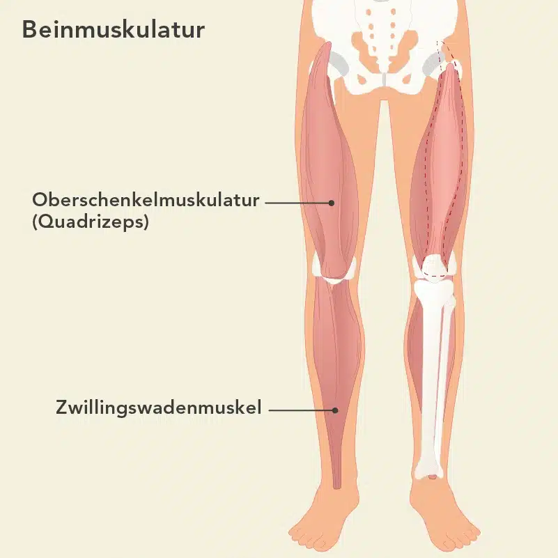 Grafische Darstellung des vierköpfigen Oberschenkelmuskels und Zwillingswadenmuskels.
