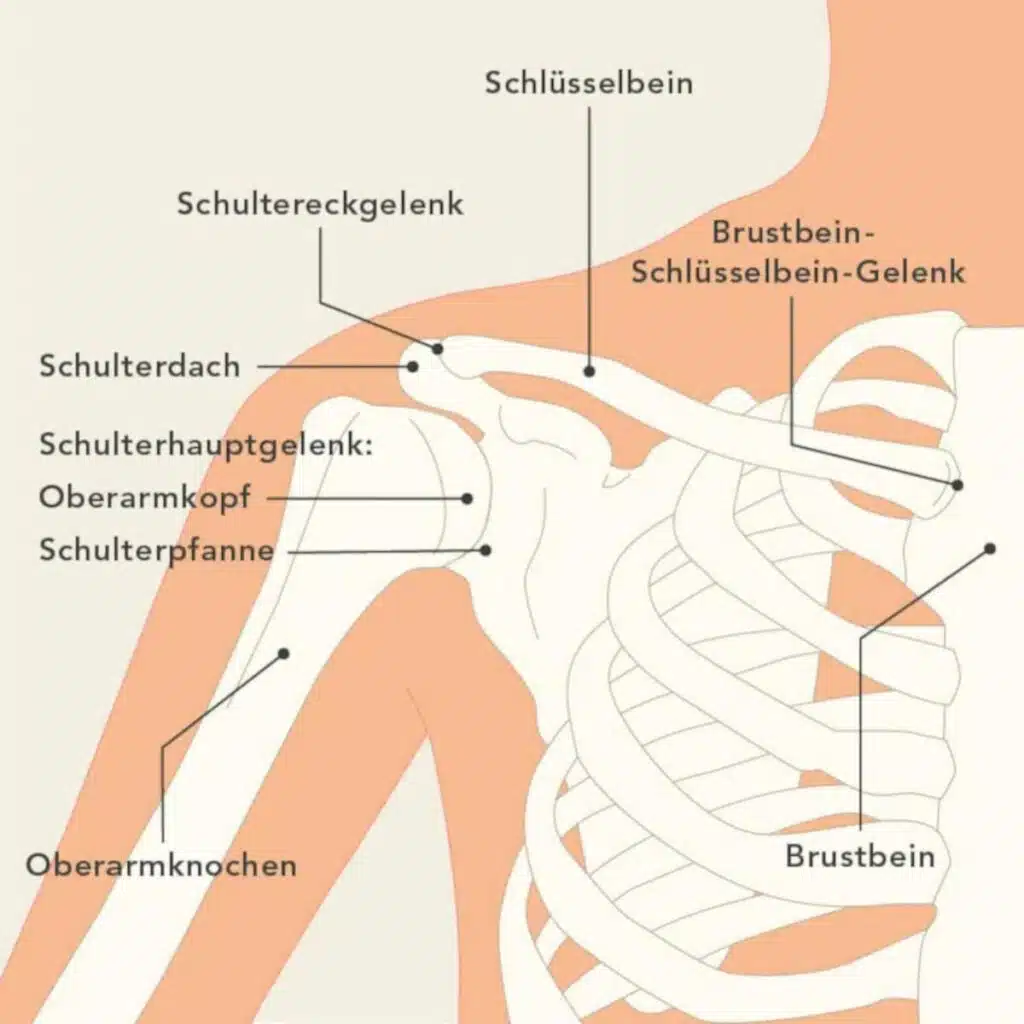 Grafische Darstellung des Schultergelenks. Die beteiligten Knochen sind eingezeichnet. Oberarmknochen und Schulterblatt bilden das Schulterhauptgelenk. Schulterdach und Schlüsselbein bilden das Schultereckgelenk. Beide Gelenke können von Schulterarthrose betroffen sein.