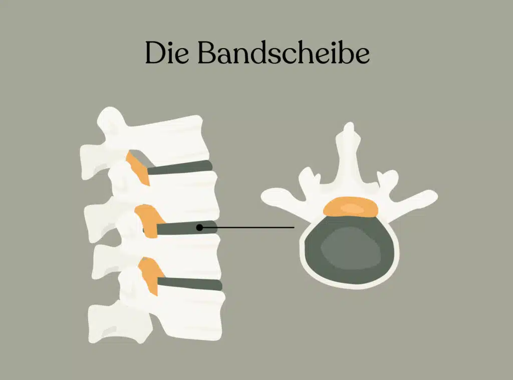 Die Bandscheibe ist ein elementarer Bestandteil unserer Wirbelsäule.