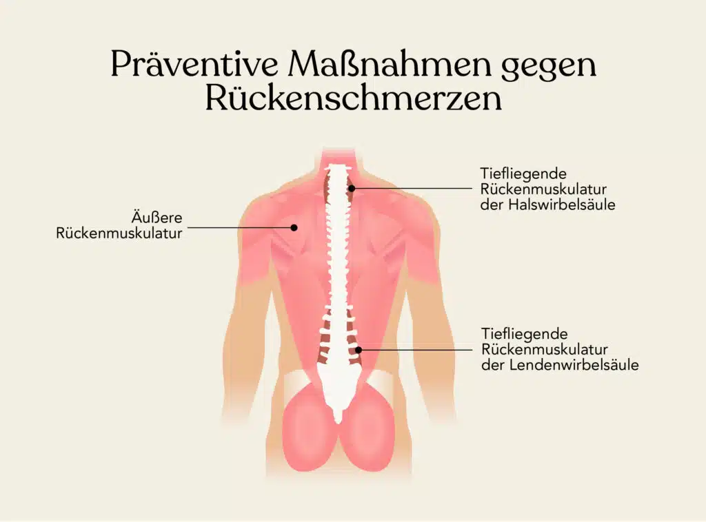 Die Rückenmuskulatur wird üblicherweise in die tiefliegende Rückenmuskulatur der Halswirbelsäule, die tiefliegende Rückenmuskulatur der Lendenwirbelsäule sowie die äußere Rückenmuskulatur aufgeteilt.