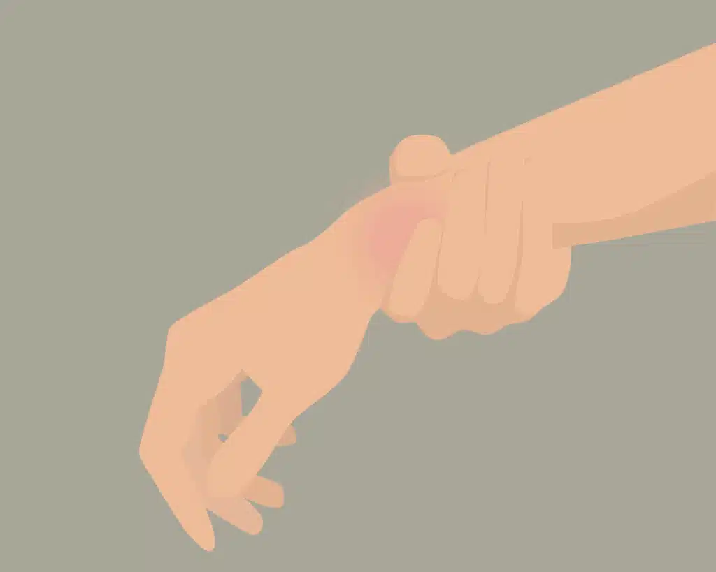 Sehnenscheidenentzündung: Ursachen, Symptome und was du tun kannst