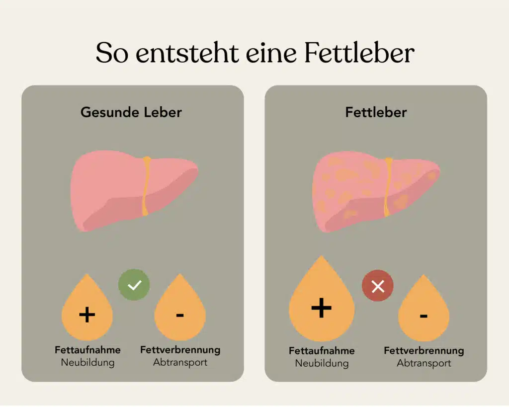 Beim Leber entgiften solltest du auf Kohlenhydrate und viel Fett verzichten.