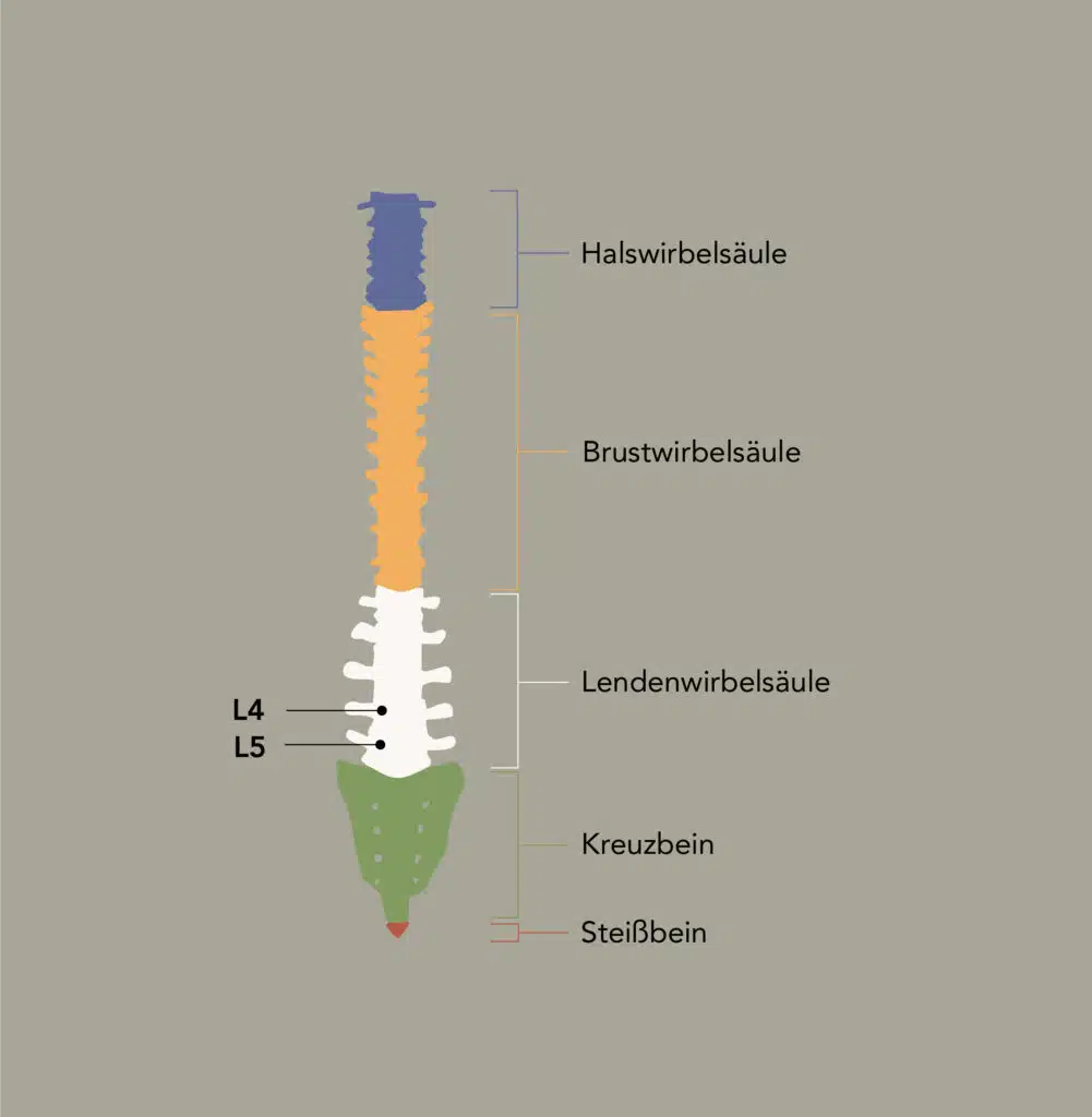 Was ist ein Hexenschuss?