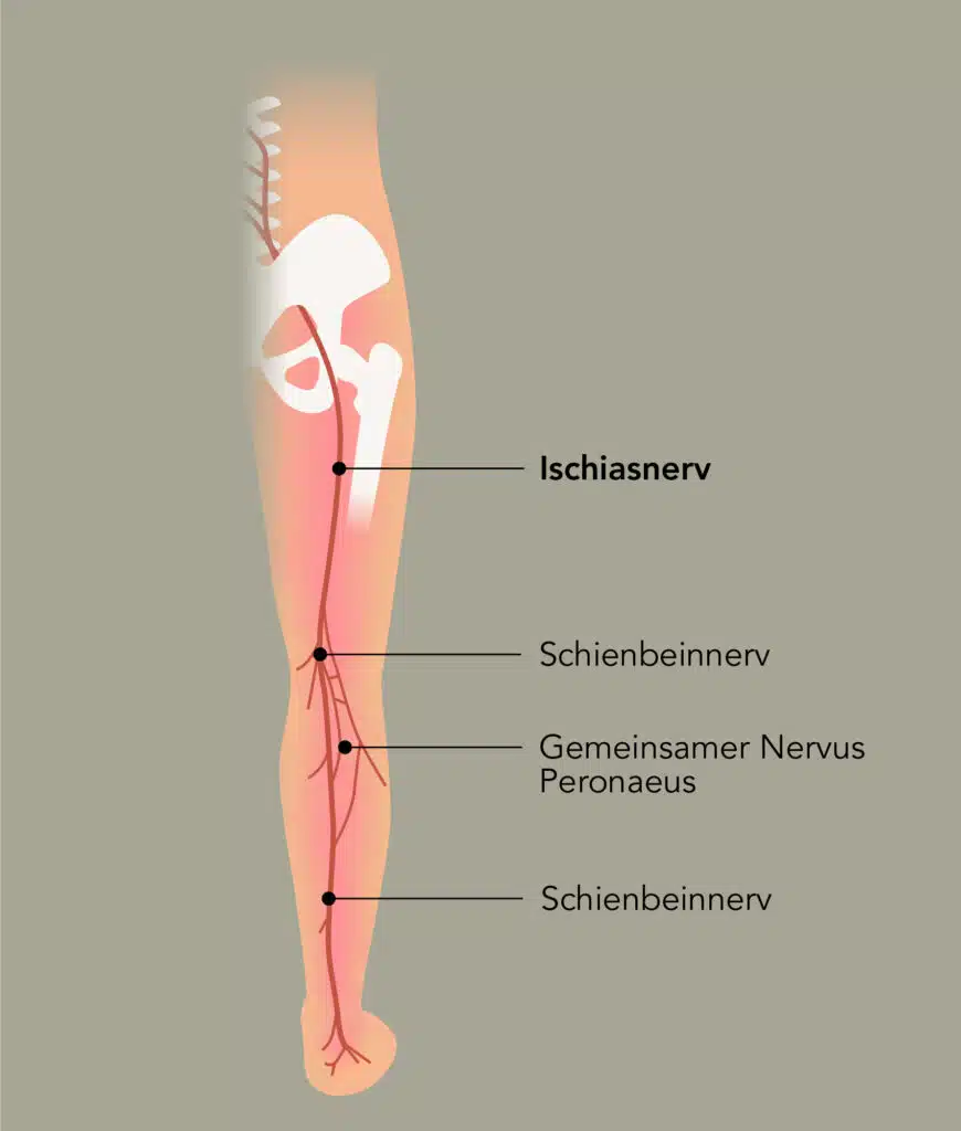 Ischiasnerv