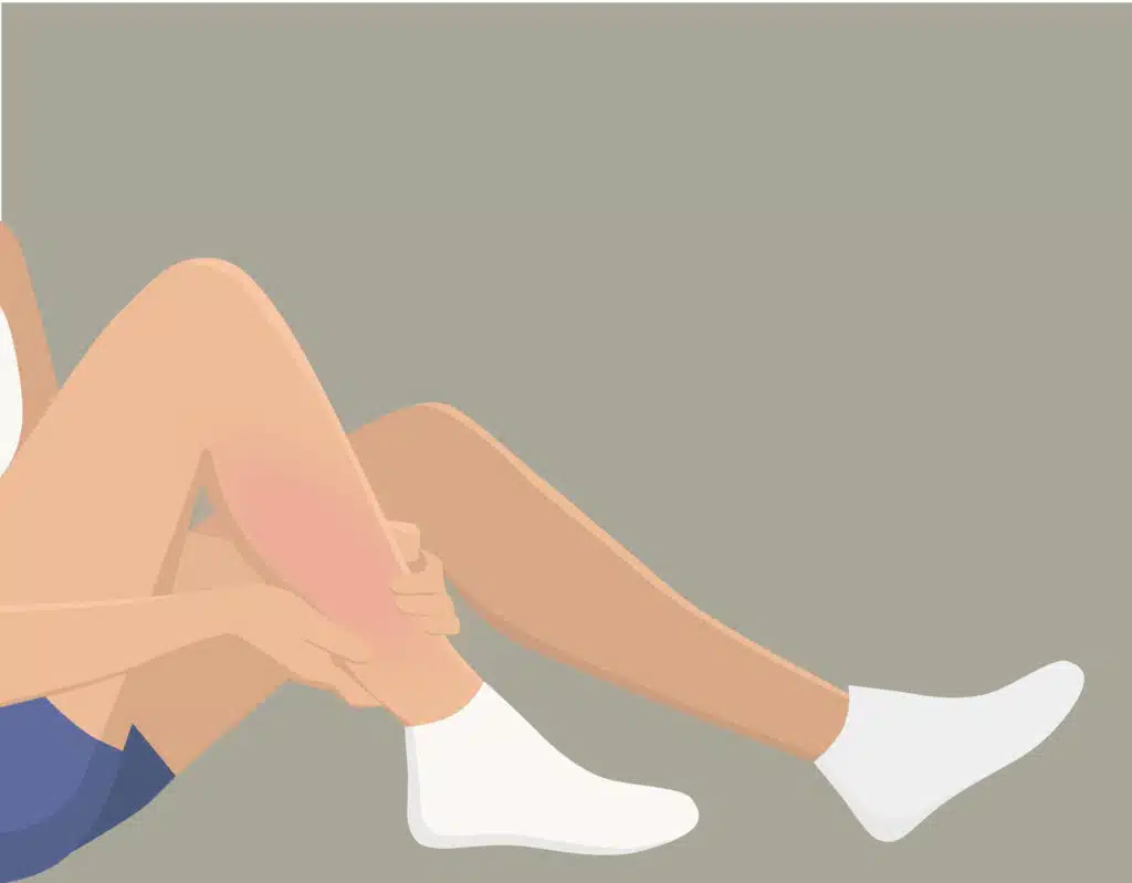 Muskelschmerzen, Myalgie? Wo liegt der Unterschied? Wir geben dir alle wichtigen Informationen über die Ursache und klären dich über eine potenzielle Therapie auf, um deine Muskulatur zu unterstützen.