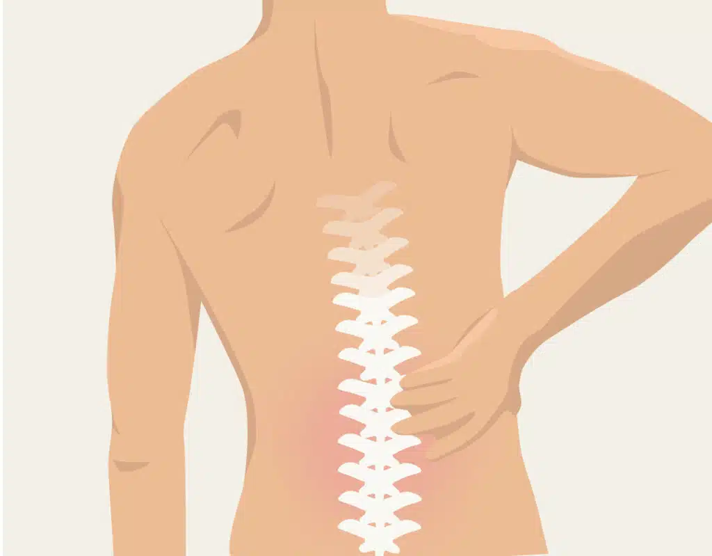 Schmerzen unterer Rücken: Ursache & Übungen | Liebscher & Bracht