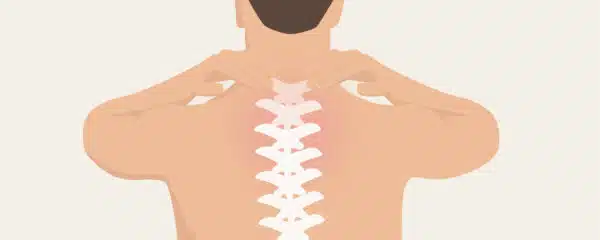 Eine Person mit einem Bandscheibenvorfall in der BWS fasst sich an den Rücken.: Ein rötlich markierter Bereich am Rücken verdeutlicht die Schmerzen in der Brustwirbelsäule.
