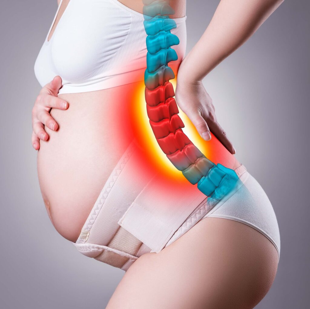 Schwangere Frau mit Bandscheibenvorfall Ansicht der Wirbelsäule und Bandscheiben