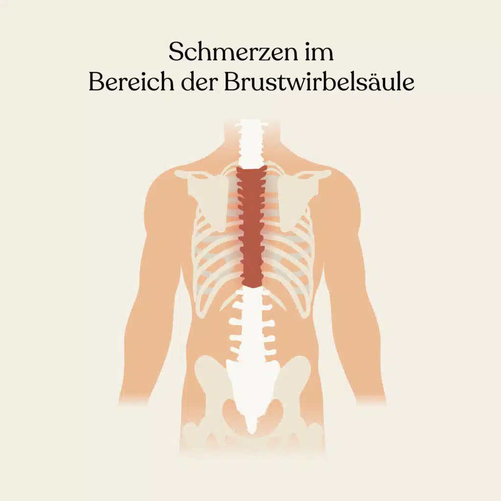 Bandscheibenvorfall BWS: Schmerzen im Bereich der Brustwirbel