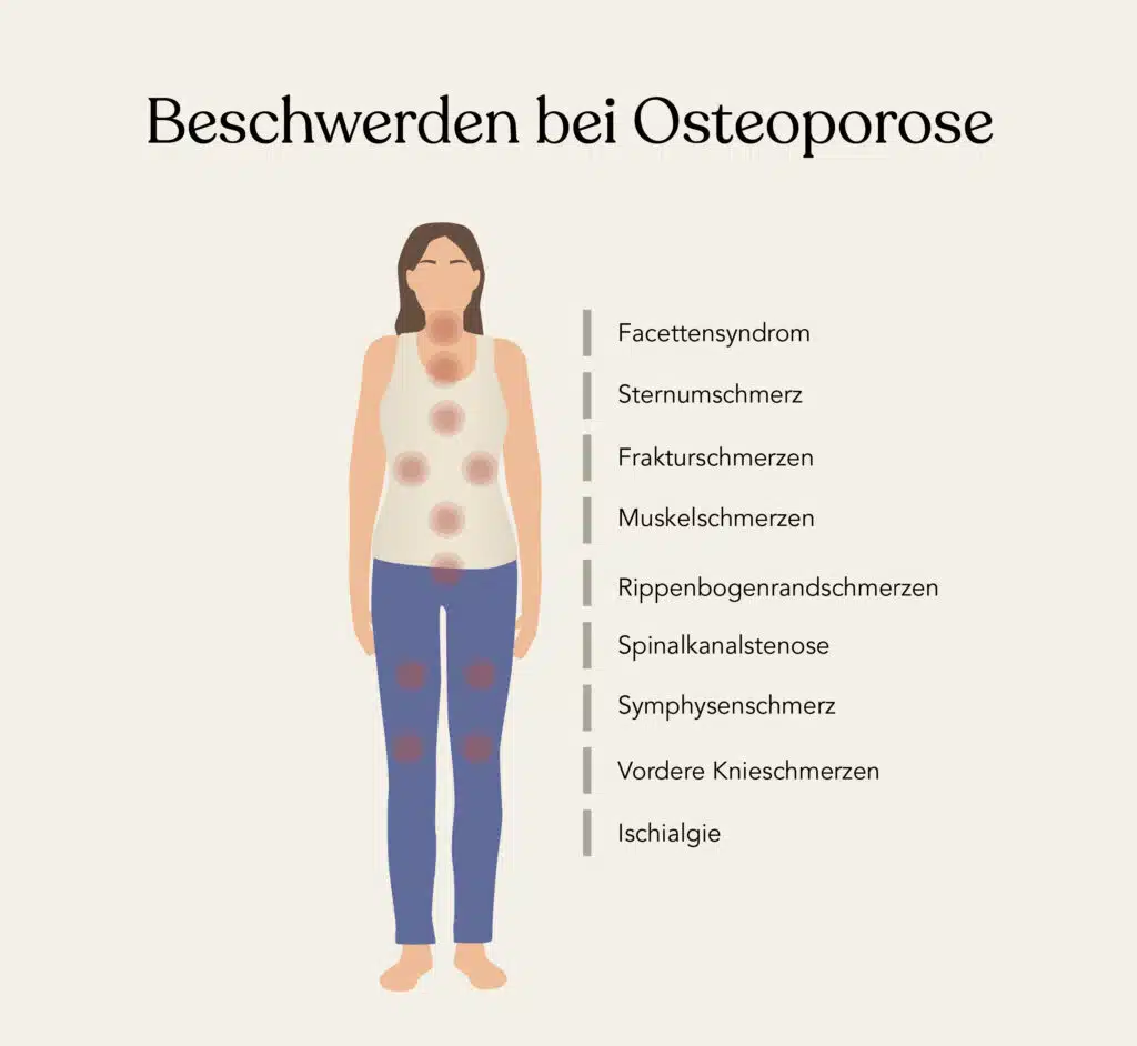 Die Beschwerden bei einer Osteoporose können sehr vielfältig sein: von Muskelschmerzen, Frakturschmerzen bis hin zu Schmerzen in den Beinen.