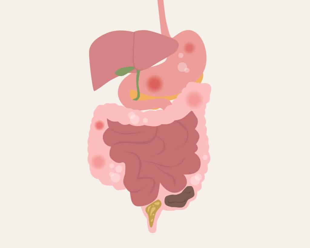 Illustration der Organe inklusive der Verdauungsorgane. Die Störung der Darmnerven könnte Durchfall und Verstopfung gleichzeitig hervorrufen.