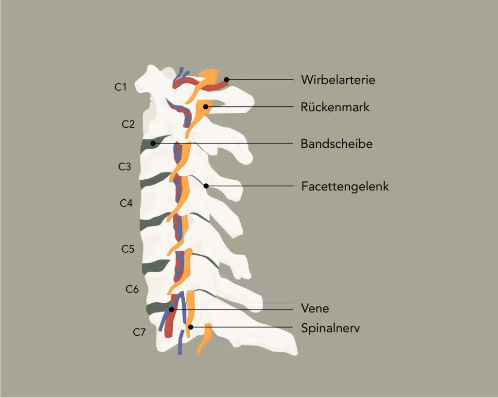 Die Enge der Halswirbelsäule kann Nackenschmerzen und Schulterschmerzen fördern.
