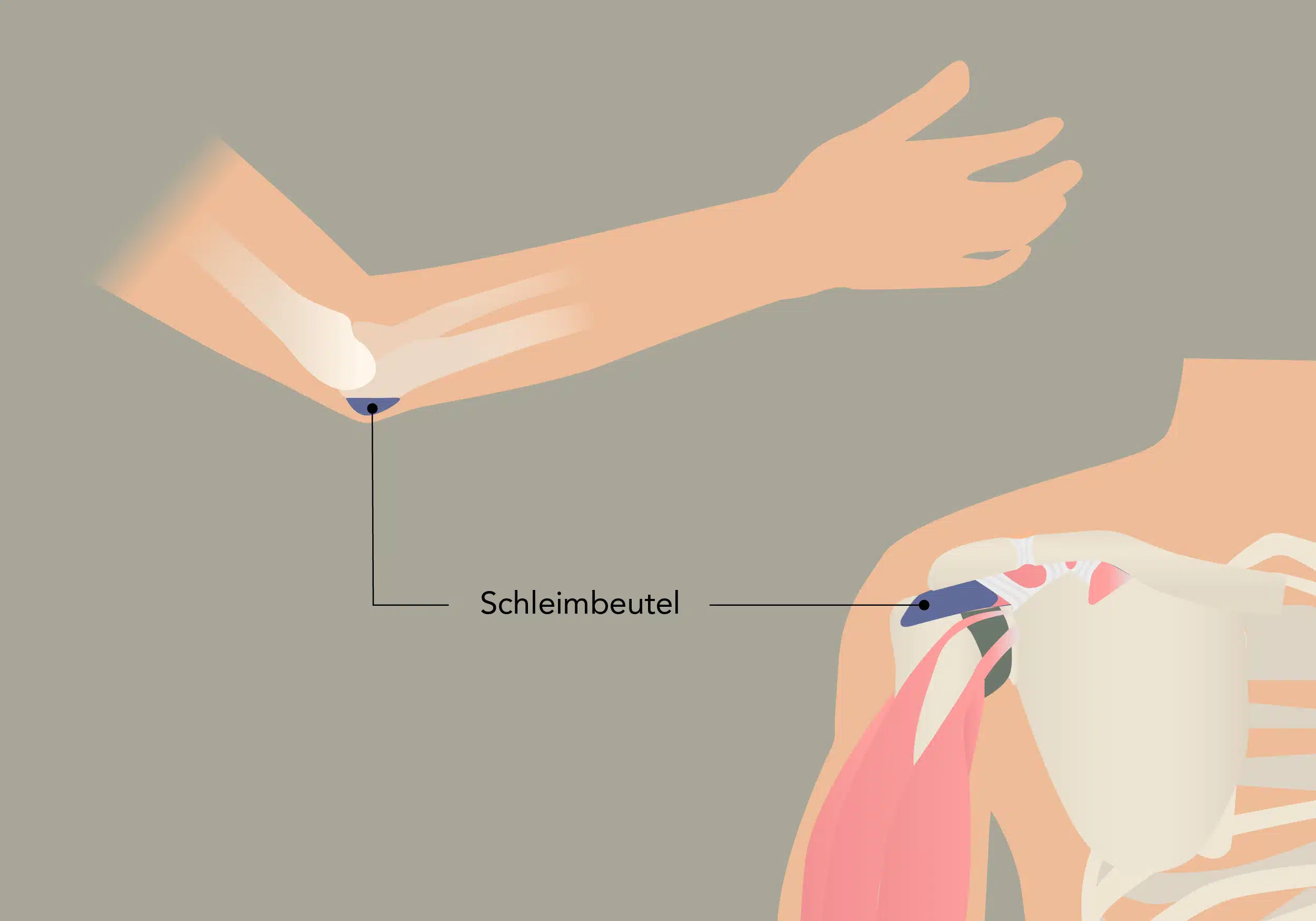 Eine Überbeanspruchung am Ellenbogen oder der Schulter kann deine Beweglichkeit in den Gelenken beeinträchtigen.