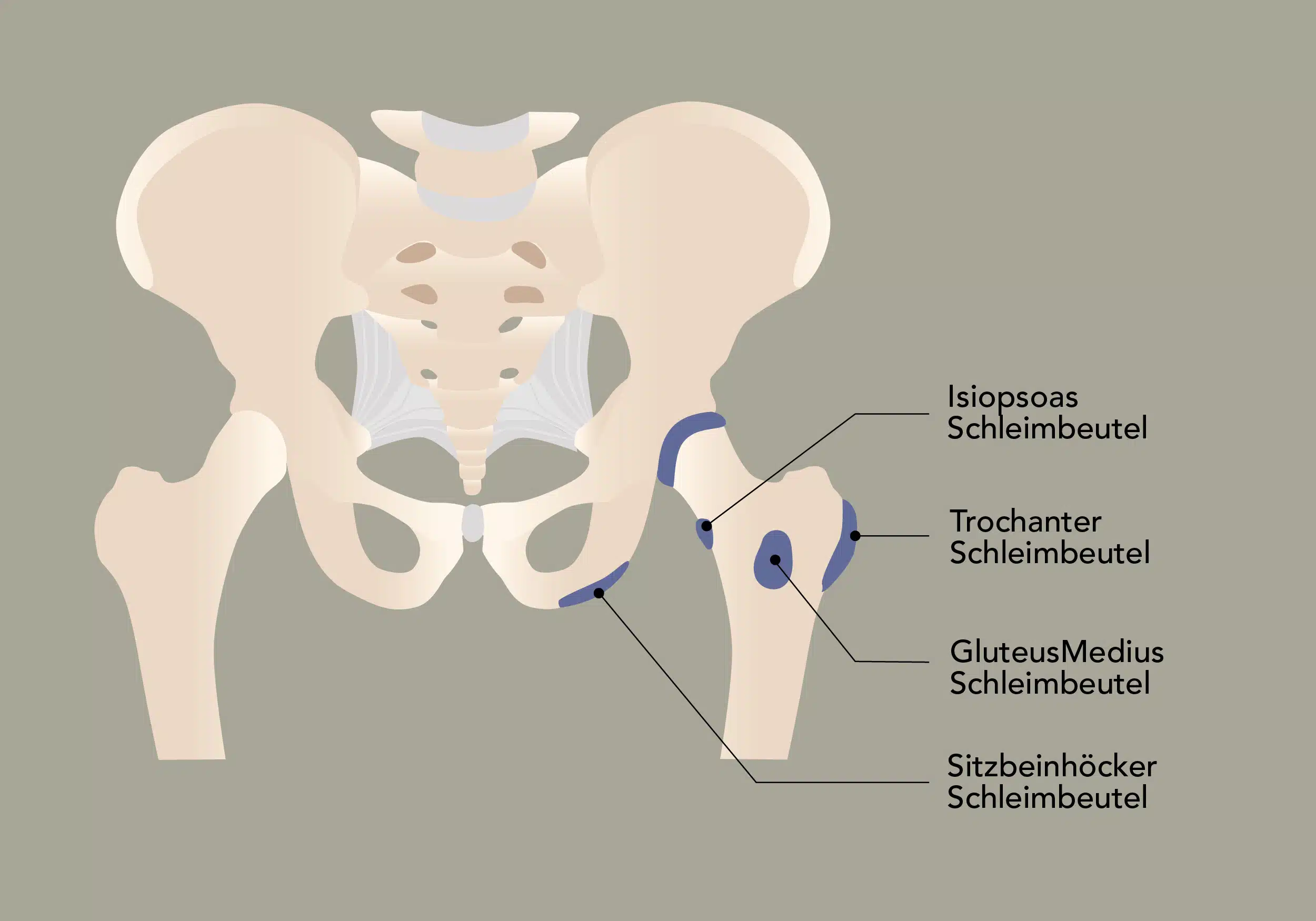 An deiner Hüfte sind der Isiopsoas Schleimbeutel, der Trochanter Schleimbeutel, der Gluteus Medius Schleimbeutel sowie die Sitzbeinhöcker Schleimbeutel angesiedelt, die für Probleme in diesem Bereich sorgen können.